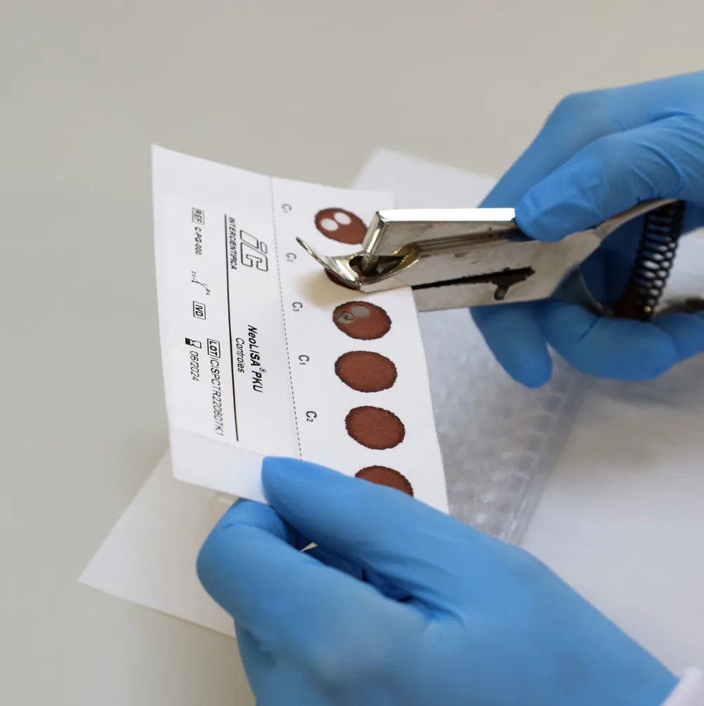 Profissional com luvas perfurando um cartão de coleta de sangue seco