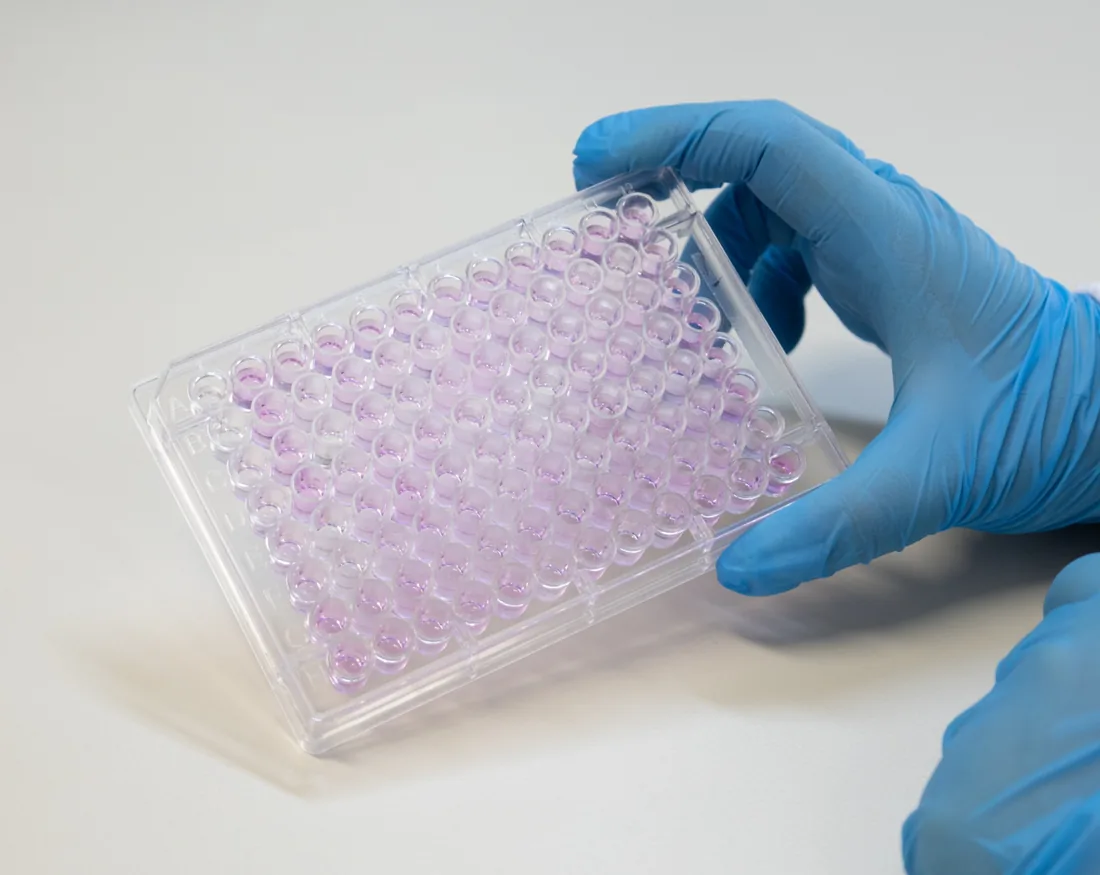 Imagem da publicação: Biotinidase – Teste Qualitativo ou Quantitativo?